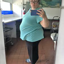 As a gynaecologist with stage iv endometriosis herself, she says you can look six months pregnant by the end of the day. This New York Mom S Endometriosis Turned Into A Deadly Form Of Ov Endofound
