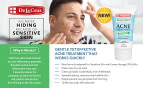 This pilot study supports the rationale for the use of topical antiandrogens in the treatment of acne vulgaris. De La Cruz 5 Sulfur Ointment Acne Medication Tube Sensitive Skin 2 6 Oz 2 22 Ebay