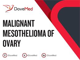 As like infiltration of the pleural lining mesothelioma is very painful and will lead you to the hospital right away. Malignant Mesothelioma Of Ovary