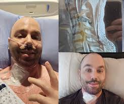 Surviving Septic Shock and Amputations: A One-Year Anniversary