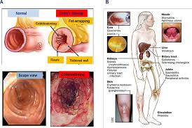 Figure 1 1 From Characterising Molecular Mechanisms Of Crohn S Disease Associated Escherichia Coli That Enable Their Survival And Replication Within Macrophages Semantic Scholar