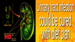 Urinary Tract Infection Could Be Cured With Diet Plan