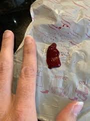 But you can take steps to increase your chances of having a healthy pregnancy. Warning Photo Is This A Miscarriage Or A Big Blood Clot Mumsnet