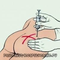 как правильно делать укол в ягодицу самому себе видео Video Kak Pravilno Delat Ukol V Yagodicu Kak Legko I Pravilno Sdelat Ukol Samomu Sebe