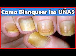 Pin De Gabriela Aldana En Omicomicosis Como Blanquear Las Unas Blanquear Las Unas Las Unas