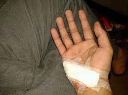 Check spelling or type a new query. Detail Gambar 95 Gambar Galau Tangan Berdarah Gambar Pixabay