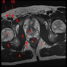 Anterior graphic of the shoulder. Male Pelvis Magnetic Resonance Imaging W Radiology