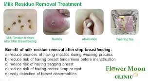 You need to wear a very tight bra, and prevent stimulation to your breasts. Tcm Lactation Treatment For Weaning Breastfeeding Problem