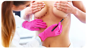 Aumento de senos - Doctor Pumarino