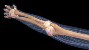 Image result for Fracture