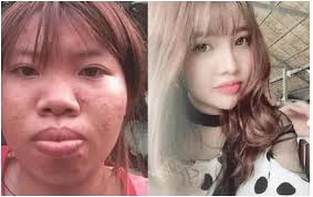 中華民國教育部版權所有© 2015 ministry of education, r.o.c. ç•¶å¹´ç‚ºå«å…¥è±ªé–€ ä¸æƒœèŠ±åè¬æ•´å®¹çš„è¶Šå—é†œå¥³ å«çµ¦å¯ŒäºŒä»£ç¾ç‹€å¦‚ä½• é ­æ¢æ–°èž