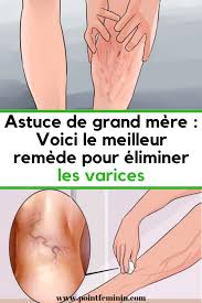 Pin On Astuces Pour Une Bonne Sante