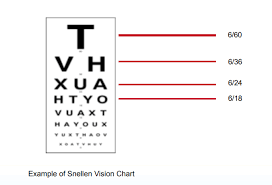 Figure 8 4 Snellen Vision Chart Opening Eyes Onto