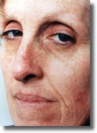 Before and After Pictures