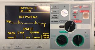 Image result for Transcutaneous Pacing