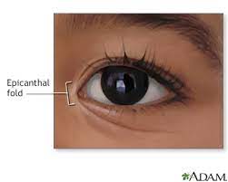 There are clinical terms ― like the epicanthal folds. Epicanthal Folds Information Mount Sinai New York