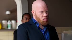 We did not find results for: Black Lightning S Tobias Is Tv S First Villain With Albinism Tv Guide