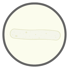 Image result for Urinary Cast