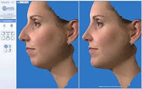 Plastic Surgery, Reconstructive Surgery & Cosmetic Surgery