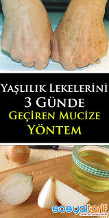 Yaslilik Lekelerini Sogan Kuruyle 3 Gunde Gecirin Homemade Skin Care Natural Remedies For Heartburn Health