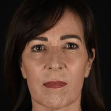 How long does a full facelift take?