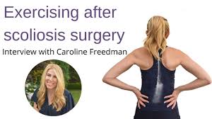 how to exercise after scoliosis surgery