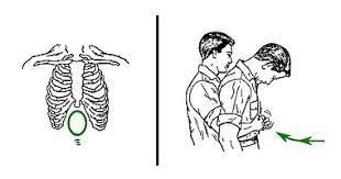The plastic bag with sedation method. Choking Wikipedia