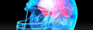 Image result for Concussion