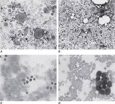 Image result for Dark Gray 1983 Caloric