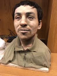 Final cause of death