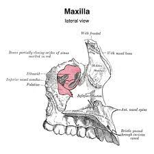 Maxilla | Radiology Reference Article | Radiopaedia.org