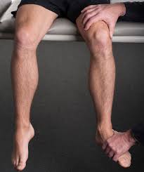 Image result for Ankle External Rotation Test