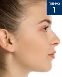 Need skin laser clinic australia or cosmetic skin clinic near me? Laser Hair Removal Side Burns Australian Skin Clinics