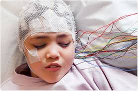 Eeg is helpful in diagnosis, demonstrating a. What Can We Learn From Eeg S Of Patient S With Epilepsy