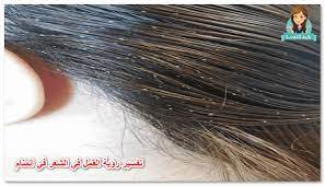 تفسير حلم القمل في الشعر مجلة كيد النسا