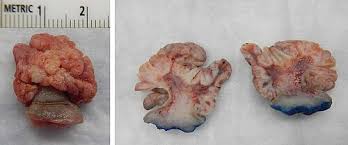 Image result for Centrostigma papillosum