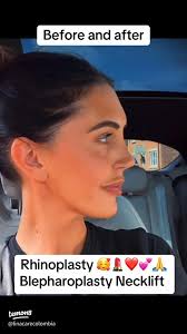 iPhoneのイケメンロック画面を作るタイムラプス