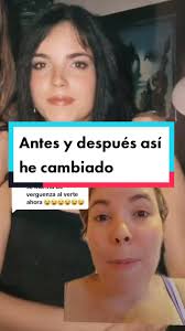Videos De Antes Y Despues En Fotos