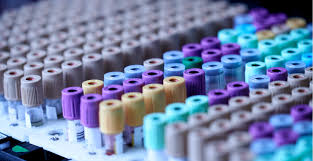 The Top 5 Things to Know About Drug Testing in Utah | ClearStar