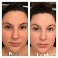 Facial creams for moisturizing and anti-aging