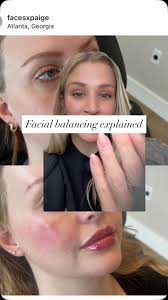 Every face tells a story and every treatment should honor it. 💫 Before any  injection, we take the time to understand your movement, your expressions,  and your goals. It's not about freezing