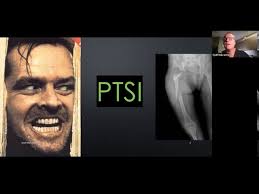 Dr. Sean Mulvaney talks about The Breakthrough in Post Traumatic Stress  Disorder