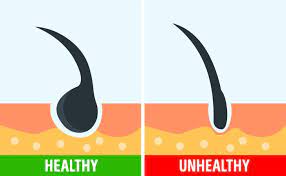 4 Ways You Can Check If Your Hair Is Healthy And How To Treat It Properly