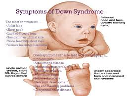Down Syndrome By Laura Perry And Alyson Rich A4 Having Down Syndrome Is Like Being Born Normal I Am Just Like You And You Are Just Like Me We Are