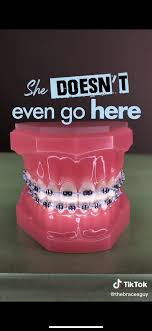 Black And White Braces For Teeth Mean Girls In 2020 Braces Colors Braces Teeth Colors Dental Braces Colors