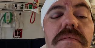 GoFundMe Launched for Graphic Designer Who Suffered Brain Injury at a  Hardcore Show