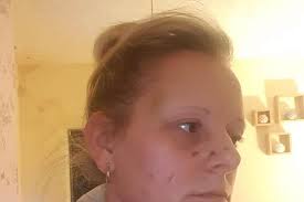 Derbyshire mum brands violent ex's suspended jail term “disgraceful”