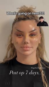 I'm not a fan of cat eyes 😝#cateyes #cateyessurgery #doctorreacts