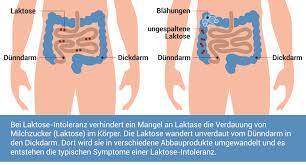 Laktoseintoleranz Symptome Ernahrung Behandlung Wolfs Apotheke Bredstedt