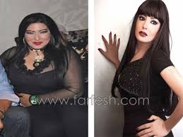 إن من يمن المرأة تبكيرها بالأنثى قبل الذكر ، وذلك أن الله تعالى قال : ÙÙ†Ø§Ù†Ø§Øª Ù‚Ø¨Ù„ ÙˆØ¨Ø¹Ø¯ Ø®Ø³Ø§Ø±Ø© Ø§Ù„ÙˆØ²Ù† Ø§Ø­Ù„Ø§Ù… Ù‚Ø¨Ù„ ÙˆØ¨Ø¹Ø¯ Ø§Ù„Ø±Ø¬ÙŠÙ…
